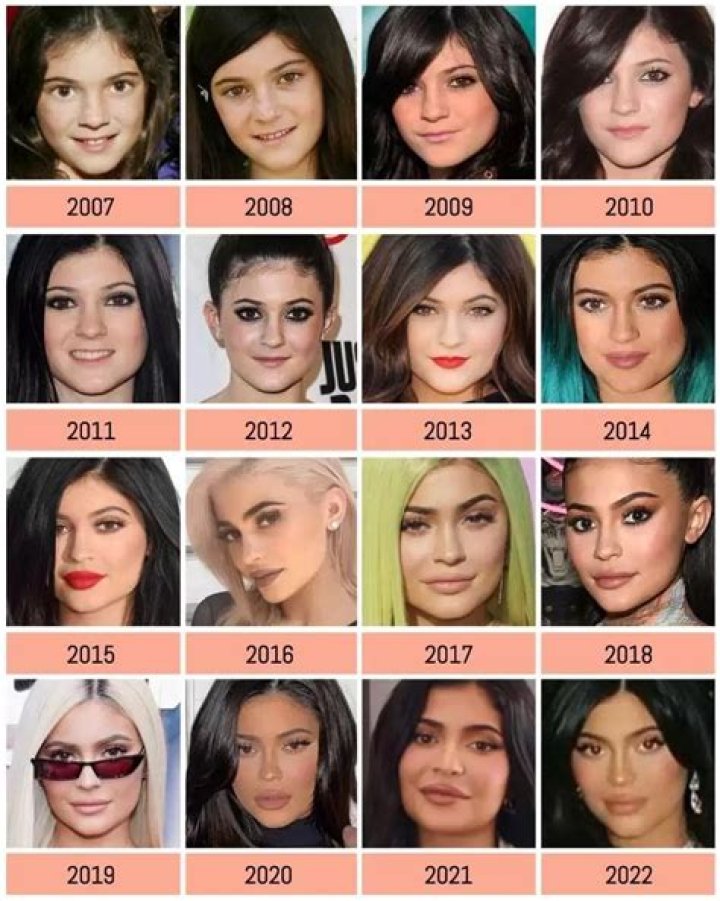 Before Her Operation, How Did Amy Schneider Look?
