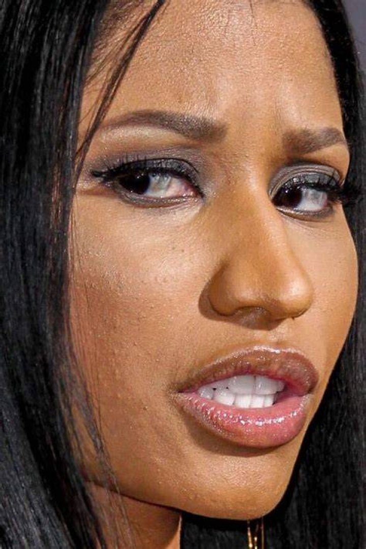 Nicki Minaj Without Teeth